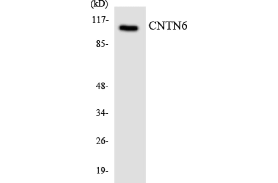 Western Blot - Anti-CNTN6 Antibody (R12-2638) - Antibodies.com