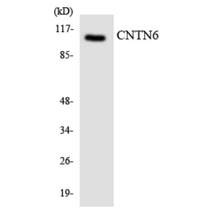 Western Blot - Anti-CNTN6 Antibody (R12-2638) - Antibodies.com