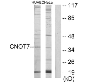 Western Blot - Anti-CNOT7 Antibody (C11858) - Antibodies.com