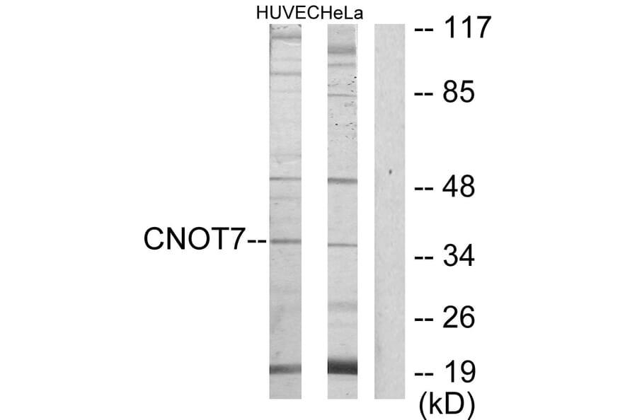 Western Blot - Anti-CNOT7 Antibody (C11858) - Antibodies.com