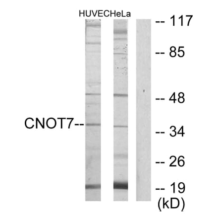 Western Blot - Anti-CNOT7 Antibody (C11858) - Antibodies.com