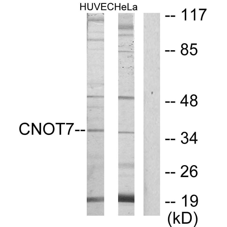 Western Blot - Anti-CNOT7 Antibody (C11858) - Antibodies.com