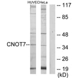 Western Blot - Anti-CNOT7 Antibody (C11858) - Antibodies.com