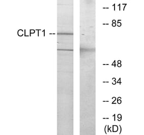 Western Blot - Anti-CLPT1 Antibody (G070) - Antibodies.com