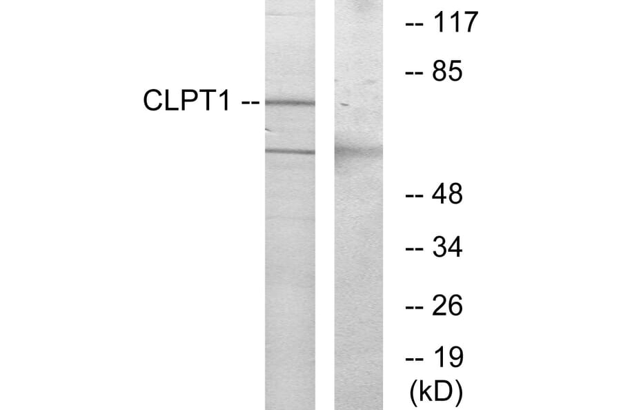 Western Blot - Anti-CLPT1 Antibody (G070) - Antibodies.com