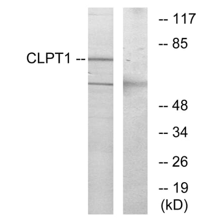 Western Blot - Anti-CLPT1 Antibody (G070) - Antibodies.com