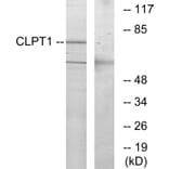 Western Blot - Anti-CLPT1 Antibody (G070) - Antibodies.com