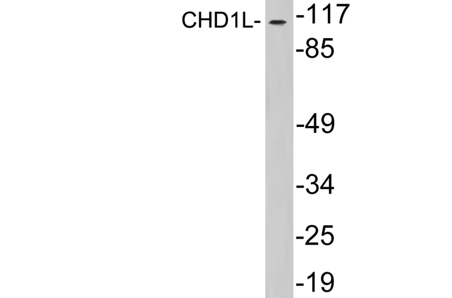 Western Blot - Anti-CHD1L Antibody (R12-2091) - Antibodies.com