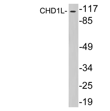 Western Blot - Anti-CHD1L Antibody (R12-2091) - Antibodies.com