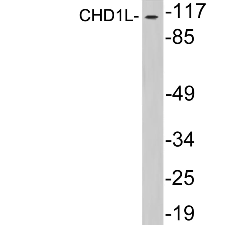 Western Blot - Anti-CHD1L Antibody (R12-2091) - Antibodies.com