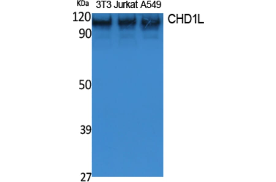 Western Blot - Anti-CHD1L Antibody (R12-2091) - Antibodies.com