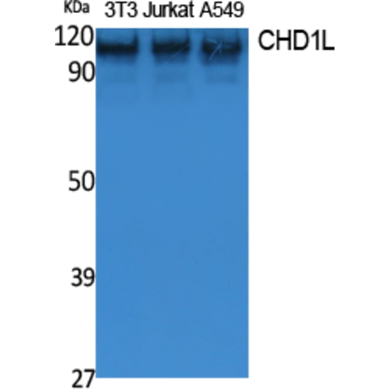 Western Blot - Anti-CHD1L Antibody (R12-2091) - Antibodies.com