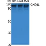 Western Blot - Anti-CHD1L Antibody (R12-2091) - Antibodies.com