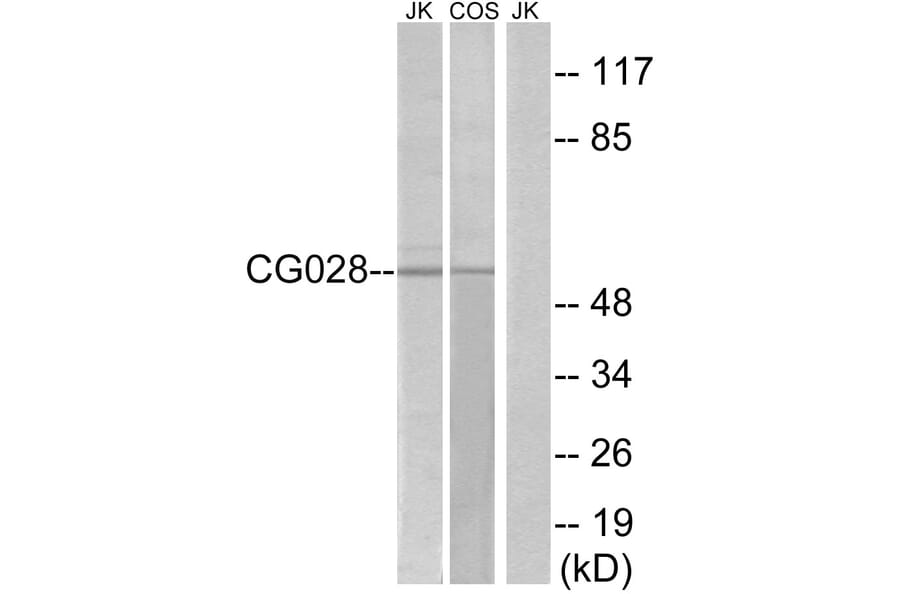 Western Blot - Anti-CG028 Antibody (G223) - Antibodies.com