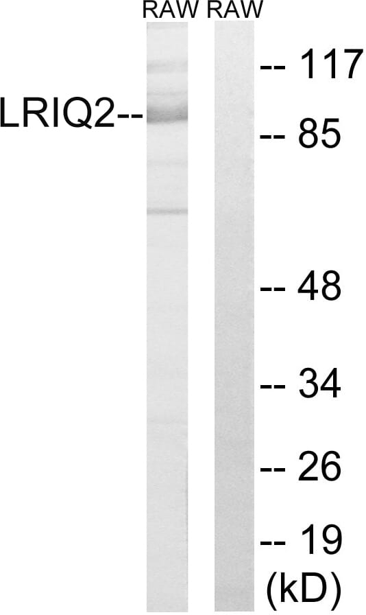 Western blot analysis of lysates from RAW264.7 cells using Anti-CEP97 Antibody. The right hand lane represents a negative control, where the antibody is blocked by the immunising peptide.