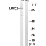 Western Blot - Anti-CEP97 Antibody (C16453) - Antibodies.com