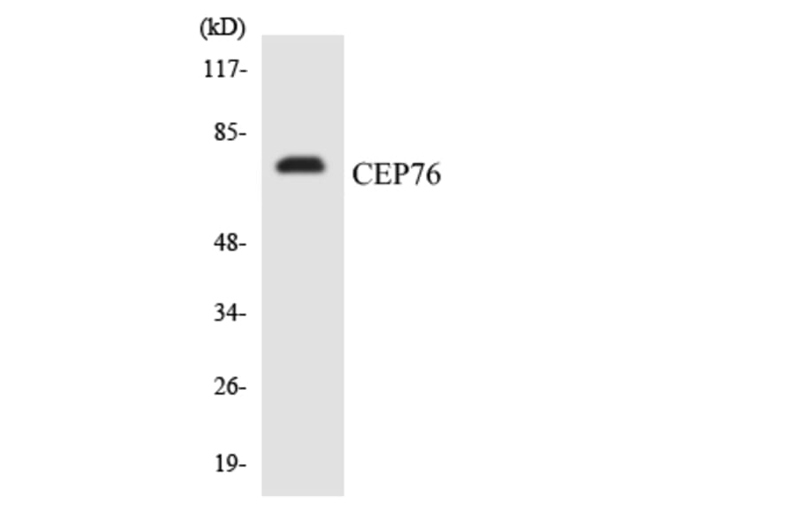 Western Blot - Anti-CEP76 Antibody (R12-2612) - Antibodies.com