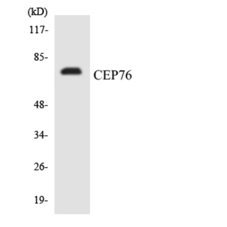 Western Blot - Anti-CEP76 Antibody (R12-2612) - Antibodies.com