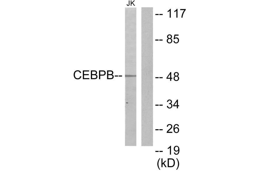 Western Blot - Anti-CEBPB Antibody (C10411) - Antibodies.com
