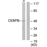Western Blot - Anti-CEBPB Antibody (C10411) - Antibodies.com