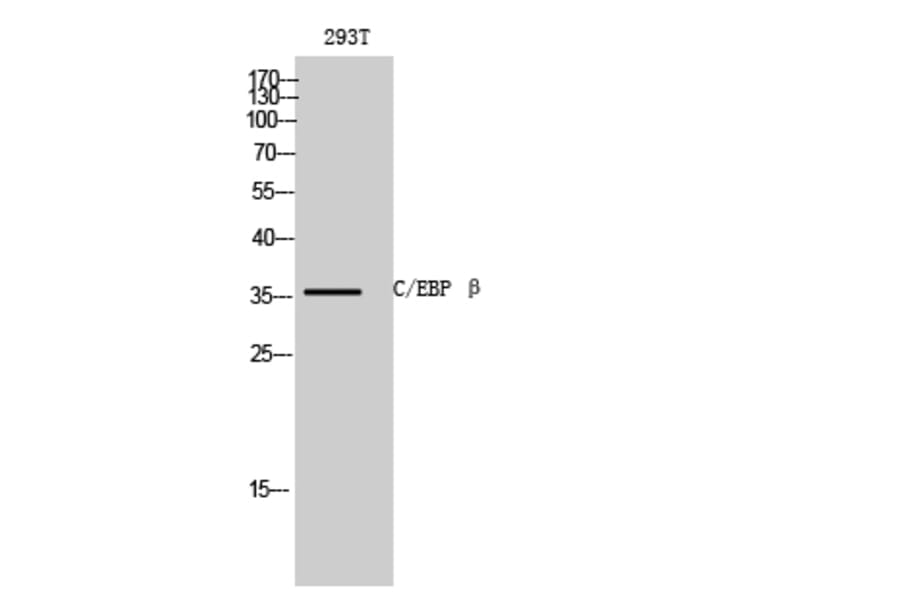 Western Blot - Anti-CEBPB Antibody (C10411) - Antibodies.com