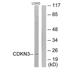 Western Blot - Anti-CDKN3 Antibody (C11137) - Antibodies.com