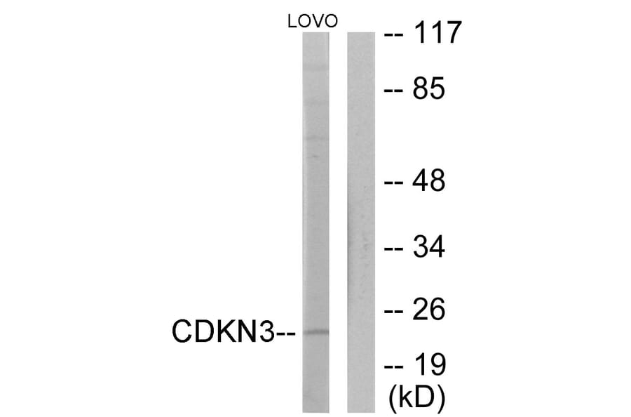 Western Blot - Anti-CDKN3 Antibody (C11137) - Antibodies.com