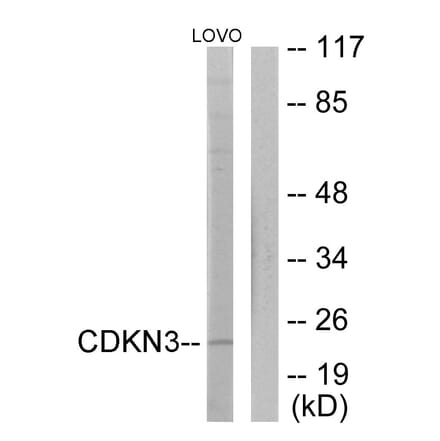 Western Blot - Anti-CDKN3 Antibody (C11137) - Antibodies.com