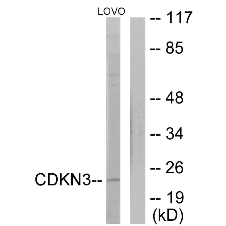 Western Blot - Anti-CDKN3 Antibody (C11137) - Antibodies.com
