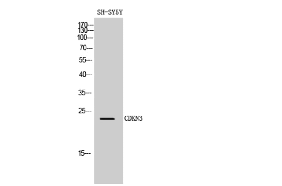 Western Blot - Anti-CDKN3 Antibody (C11137) - Antibodies.com
