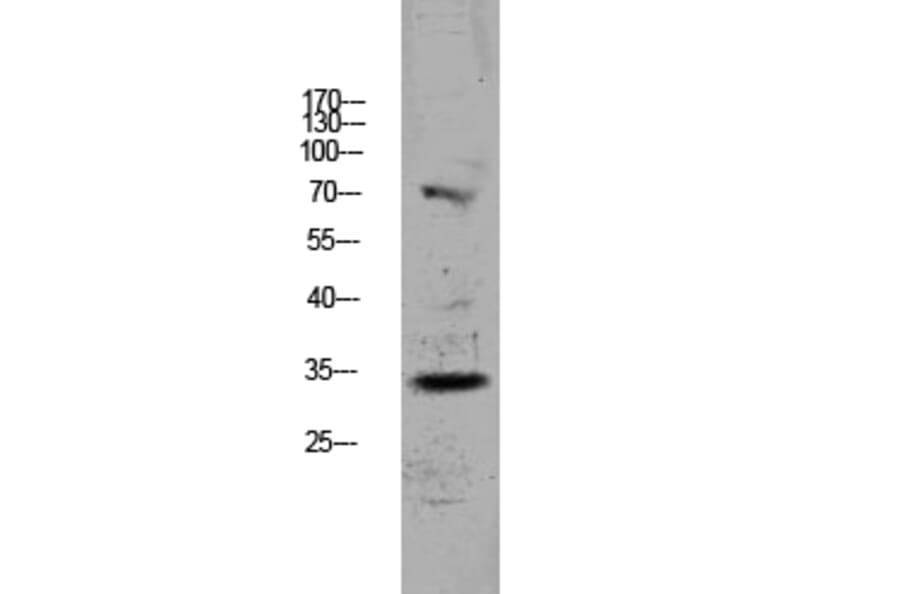 Western Blot - Anti-CDKN3 Antibody (C11137) - Antibodies.com