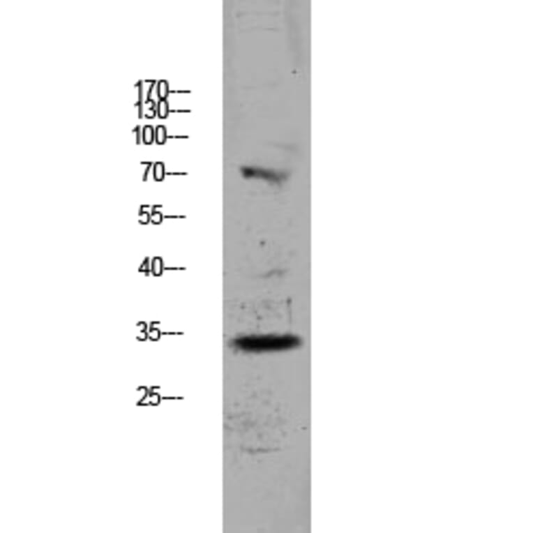 Western Blot - Anti-CDKN3 Antibody (C11137) - Antibodies.com