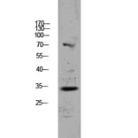 Western Blot - Anti-CDKN3 Antibody (C11137) - Antibodies.com