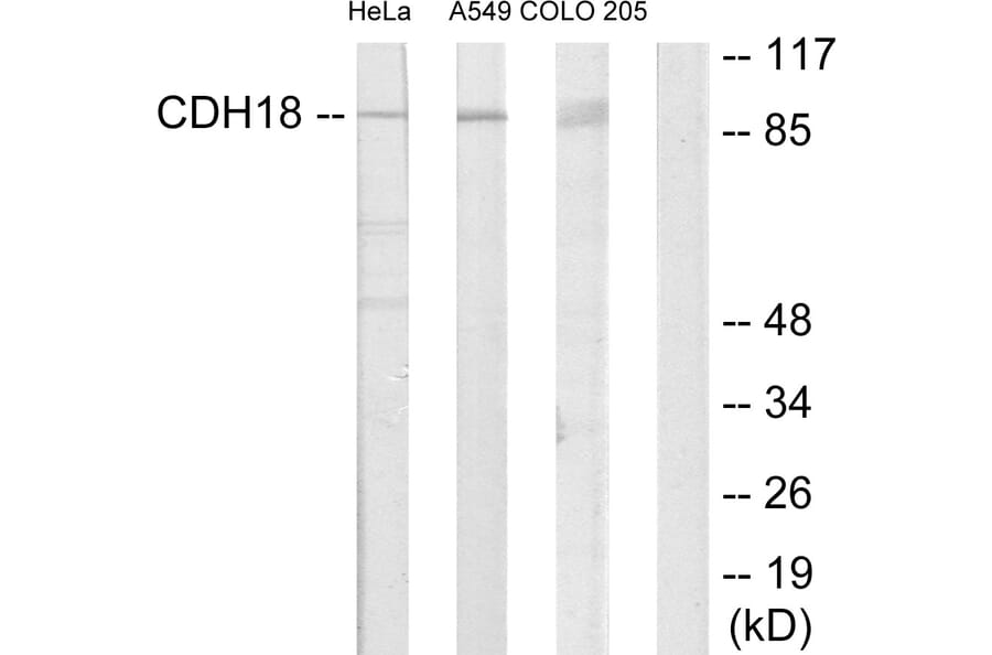 Western Blot - Anti-CDH18 Antibody (C12093) - Antibodies.com