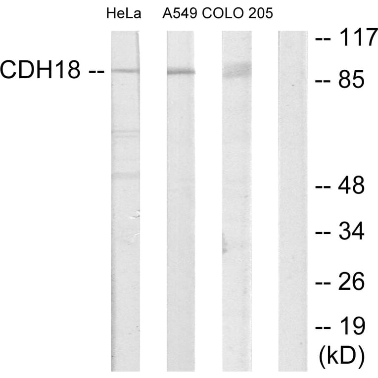 Western Blot - Anti-CDH18 Antibody (C12093) - Antibodies.com