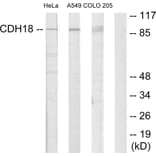 Western Blot - Anti-CDH18 Antibody (C12093) - Antibodies.com