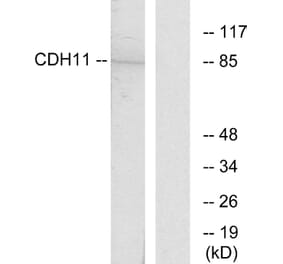 Western Blot - Anti-CDH11 Antibody (C12087) - Antibodies.com