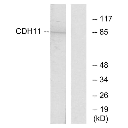 Western Blot - Anti-CDH11 Antibody (C12087) - Antibodies.com