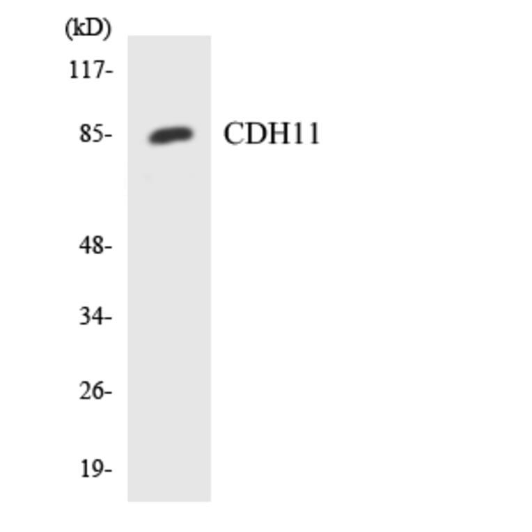 Western Blot - Anti-CDH11 Antibody (R12-2599) - Antibodies.com