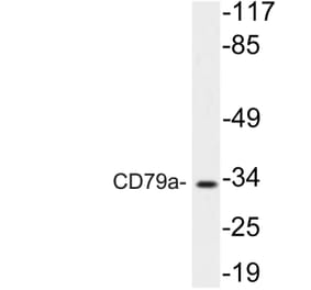 Western Blot - Anti-CD79a Antibody (R12-2083) - Antibodies.com