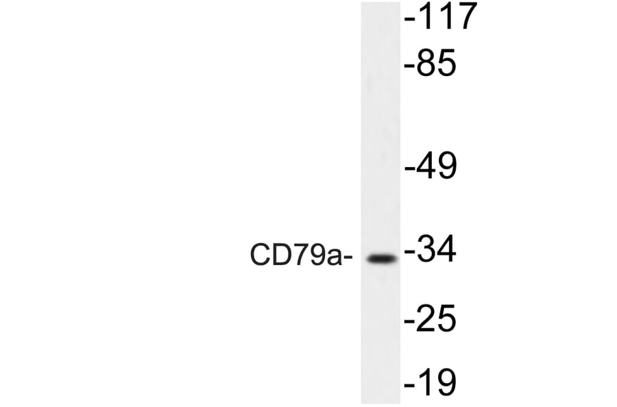 Western Blot - Anti-CD79a Antibody (R12-2083) - Antibodies.com