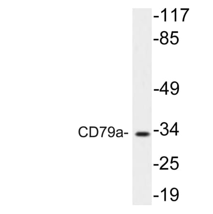 Western Blot - Anti-CD79a Antibody (R12-2083) - Antibodies.com