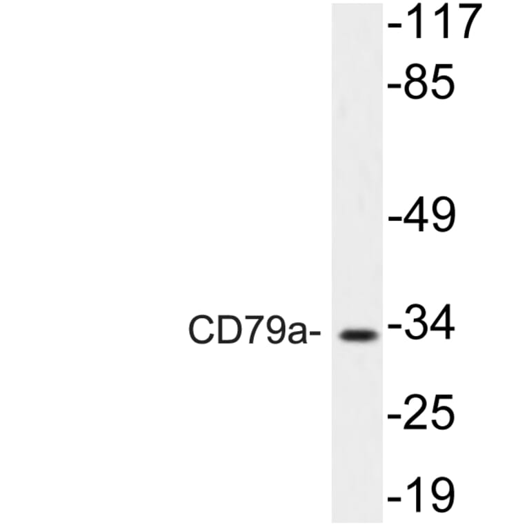 Western Blot - Anti-CD79a Antibody (R12-2083) - Antibodies.com
