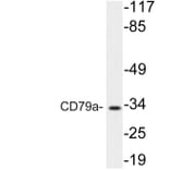 Western Blot - Anti-CD79a Antibody (R12-2083) - Antibodies.com