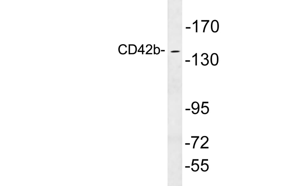 Western Blot - Anti-CD42b Antibody (R12-2079) - Antibodies.com
