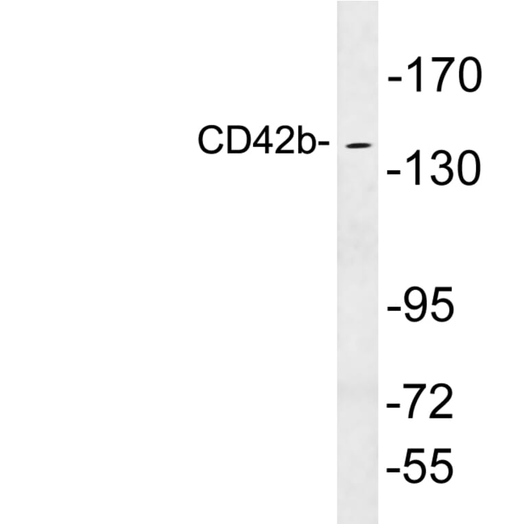 Western Blot - Anti-CD42b Antibody (R12-2079) - Antibodies.com