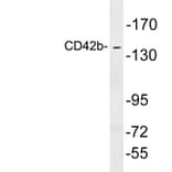 Western Blot - Anti-CD42b Antibody (R12-2079) - Antibodies.com