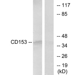 Western Blot - Anti-CD153 Antibody (C10540) - Antibodies.com