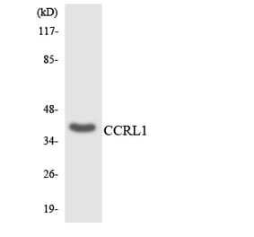 Western Blot - Anti-CCRL1 Antibody (R12-2580) - Antibodies.com