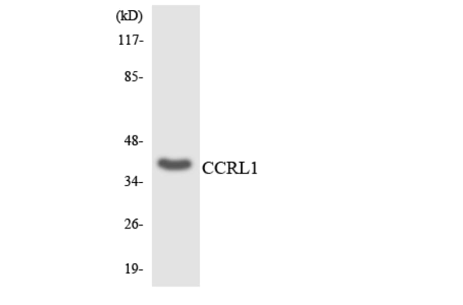 Western Blot - Anti-CCRL1 Antibody (R12-2580) - Antibodies.com